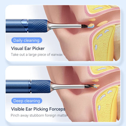 Limnis™ Ear Wax Removal Tool with Camera